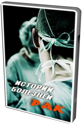 Истории болезней. Рак