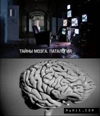 Тайны мозга. Патология / Mysteries of the brain. Pathology VO