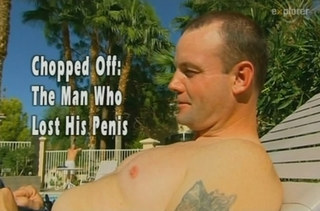Мужчина, который потерял пенис / Chopped Off: The Man Who Lost His Penis