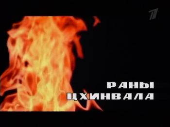 Раны Цхинвала / Раны Цхинвала