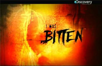 Меня укусили / Discovery:I was bitten