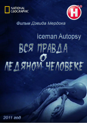 Вся правда о ледяном человеке / Iceman Autopsy VO