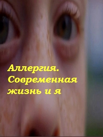 Аллергия. Современная жизнь и я / Allergies: Modern Life and Me VO