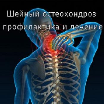 Шейный остеохондроз профилактика и лечение
