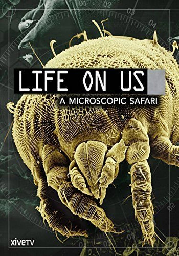 Жизнь на нашем теле (2 серии из 2) / Life on Us VO